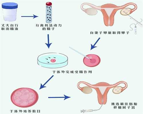 南京代孕一个孩子多少钱：输卵管结扎术的利弊