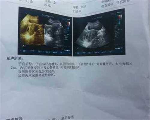 昆明中国代怀孕多少钱2017,怀男孩几个月开始胎动